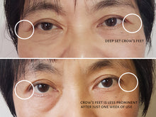 Load image into Gallery viewer, Decora Corner Creme® Ultimate Skin Rejuvenation Anti-Aging &amp; Skin Tightening System
